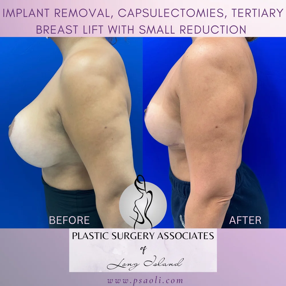 Untitled (Instagram Post (Square)) – 5