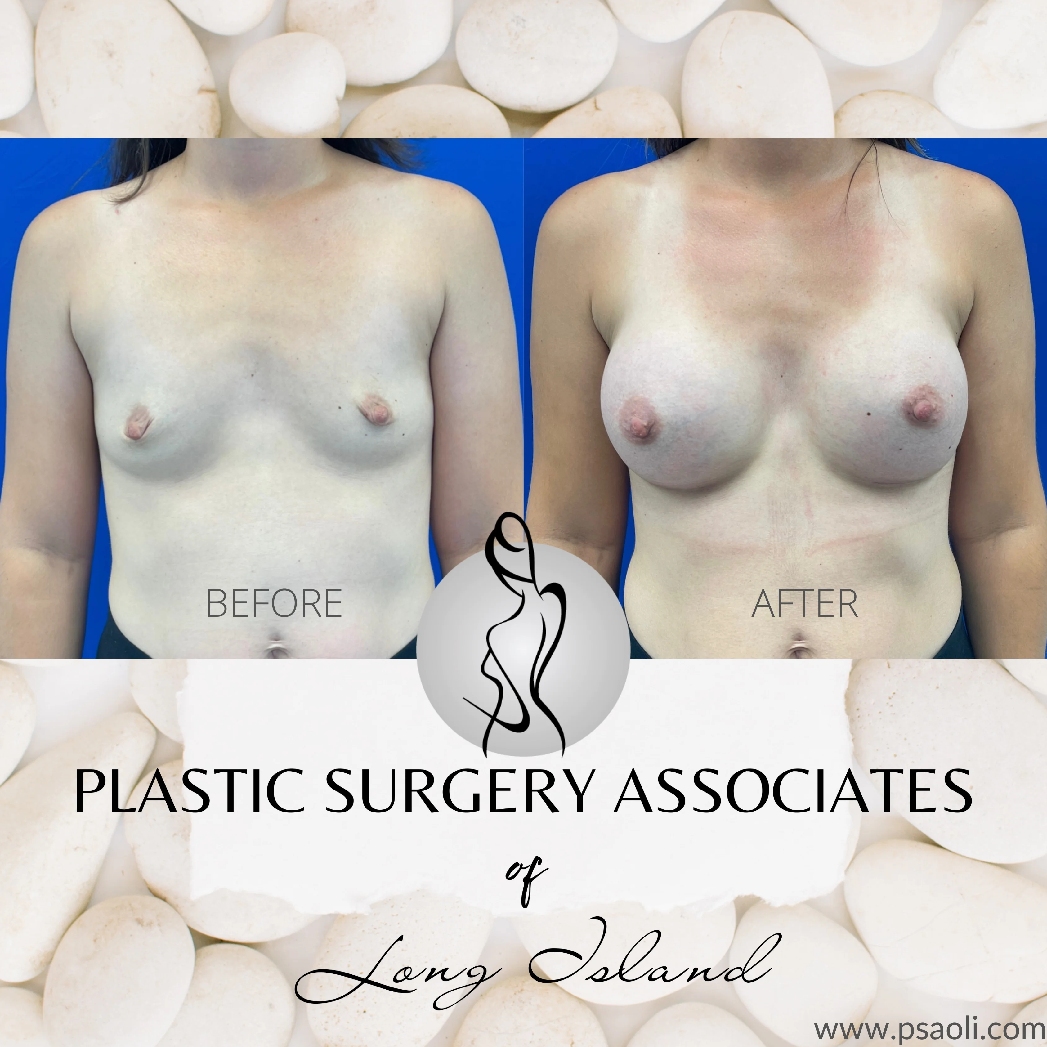 White Floral Client testimonial Instagram Post – 1