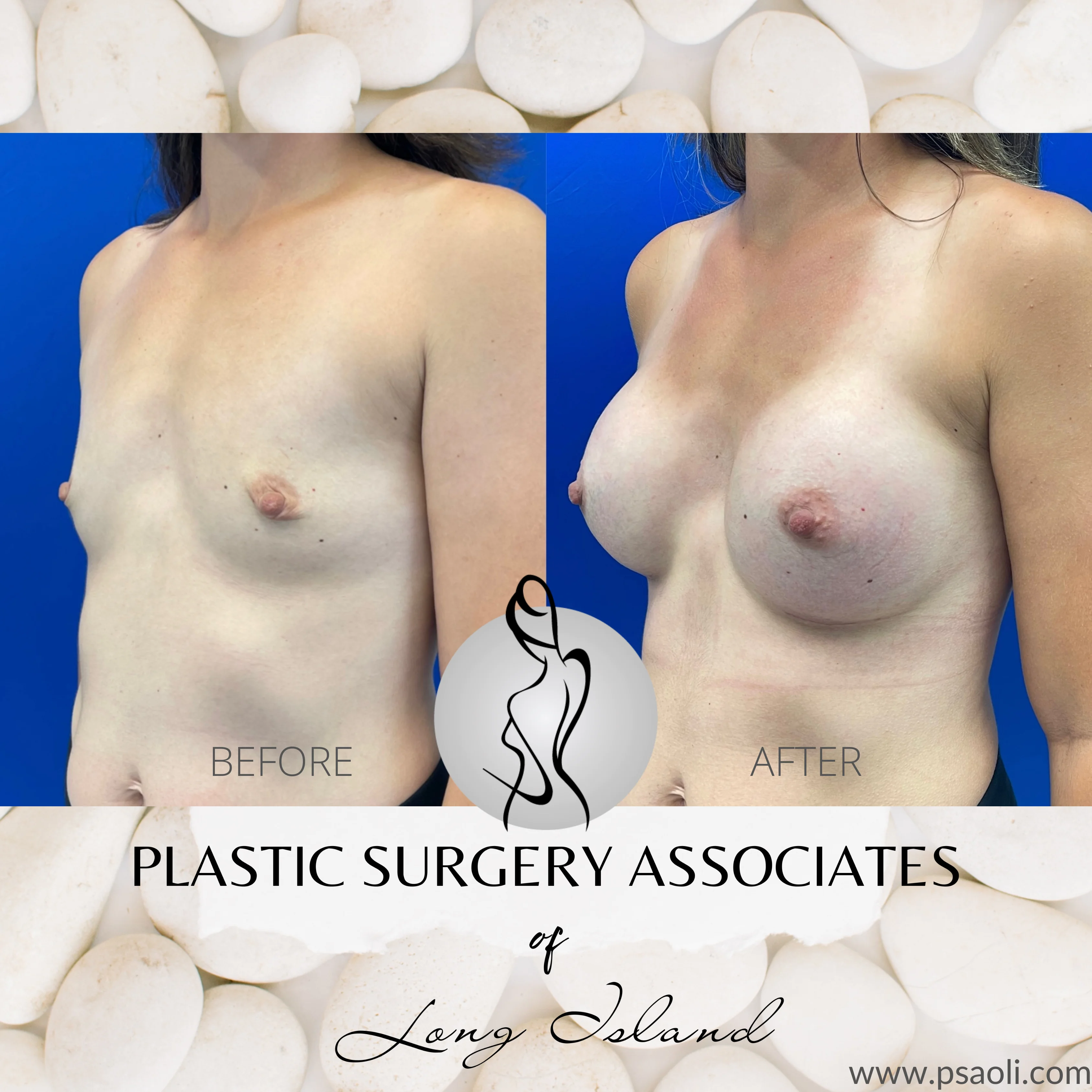 White Floral Client testimonial Instagram Post – 2