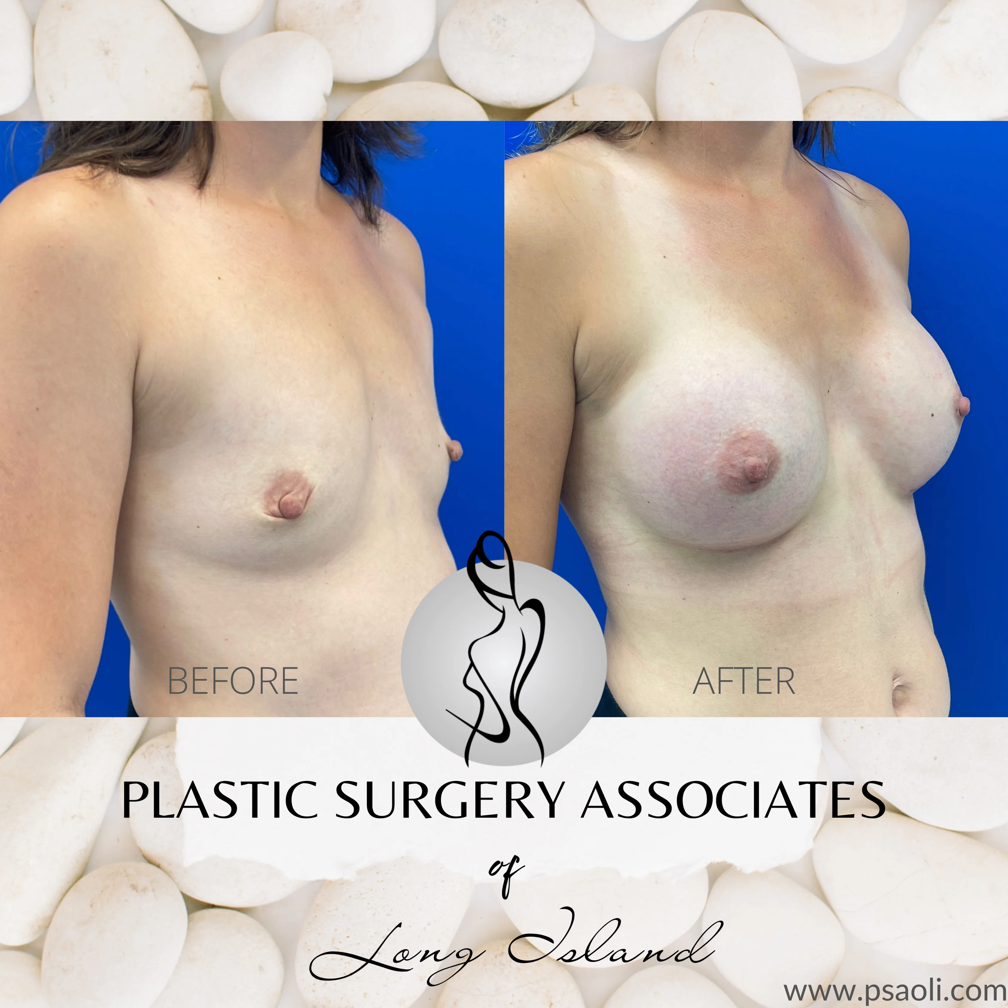 White Floral Client testimonial Instagram Post – 3