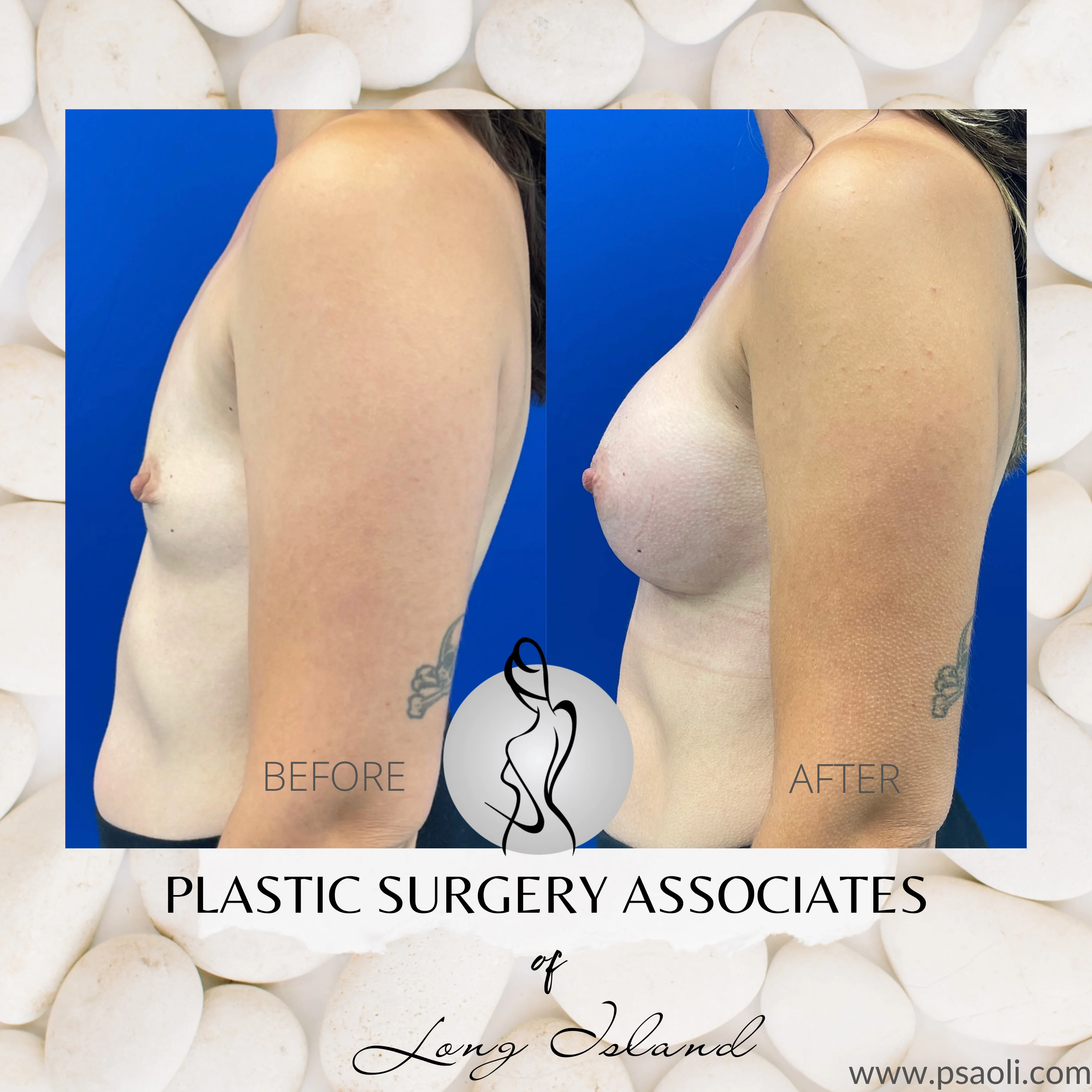 White Floral Client testimonial Instagram Post – 4