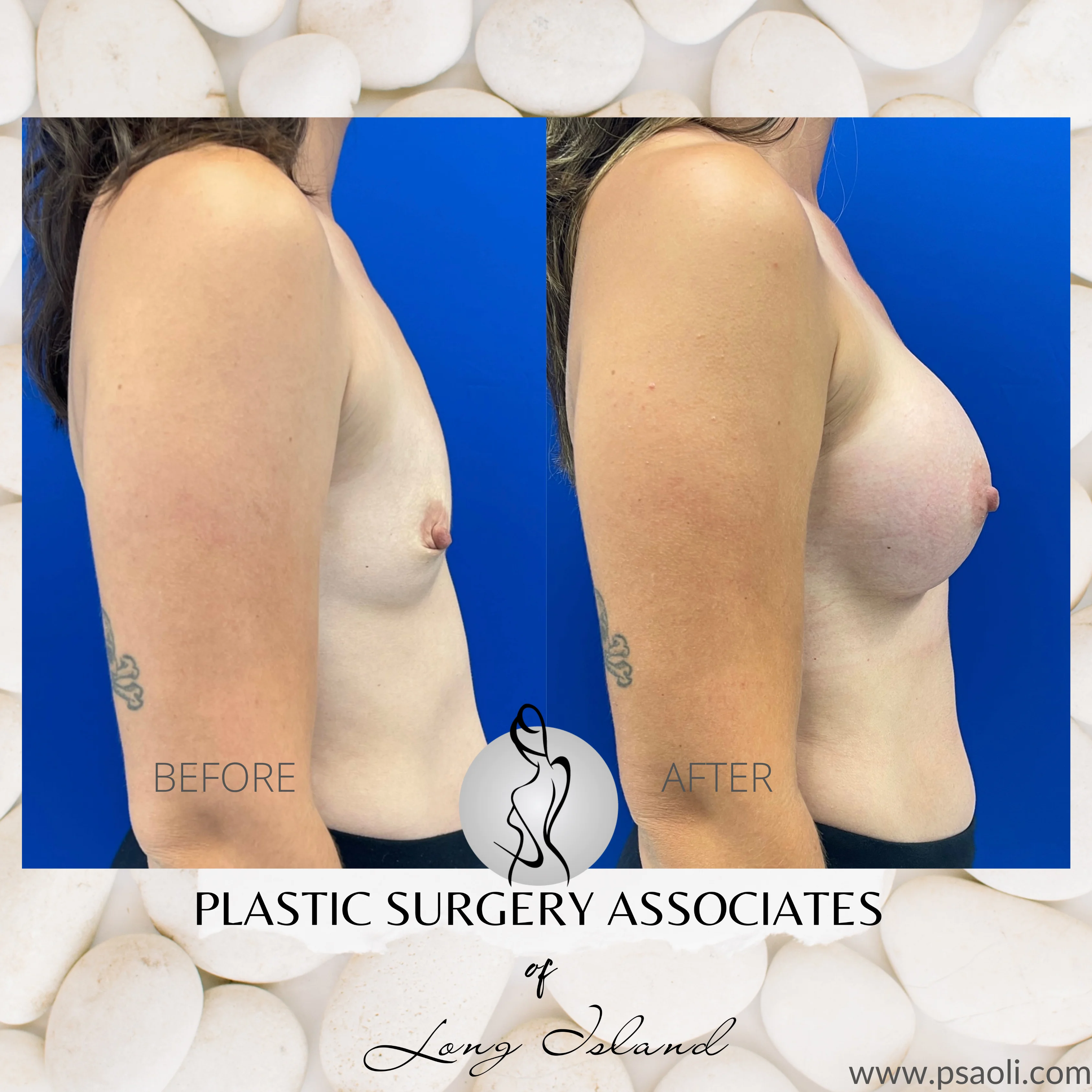 White Floral Client testimonial Instagram Post – 5