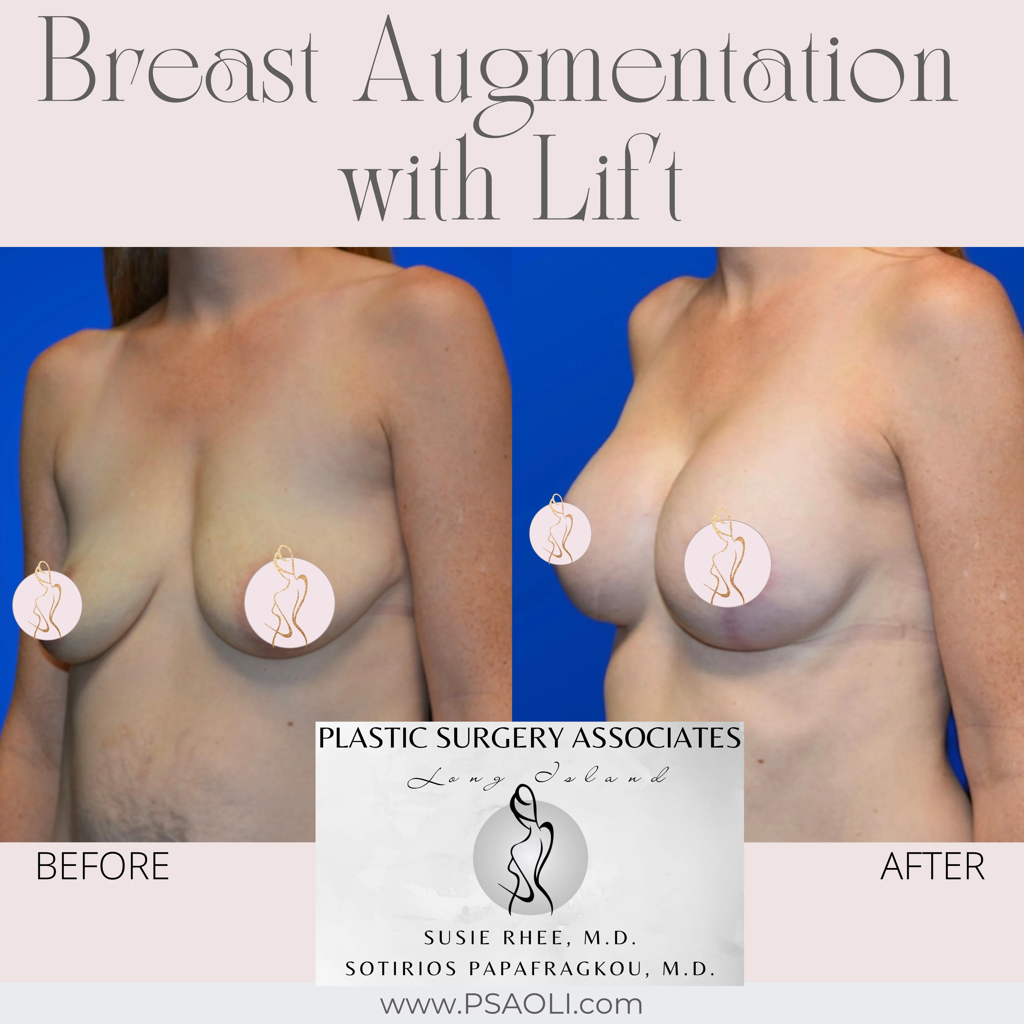 White Minimalist Happy National Pet Day Instagram Post – 2